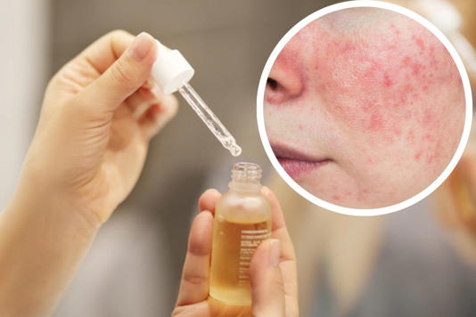  Retiran del mercado serum facial por contaminación bacteriana que causa infección en la piel